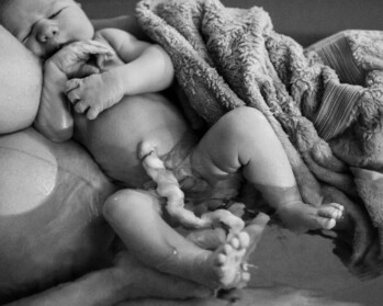 newborn baby minutes after birth with the umbilical cord attached